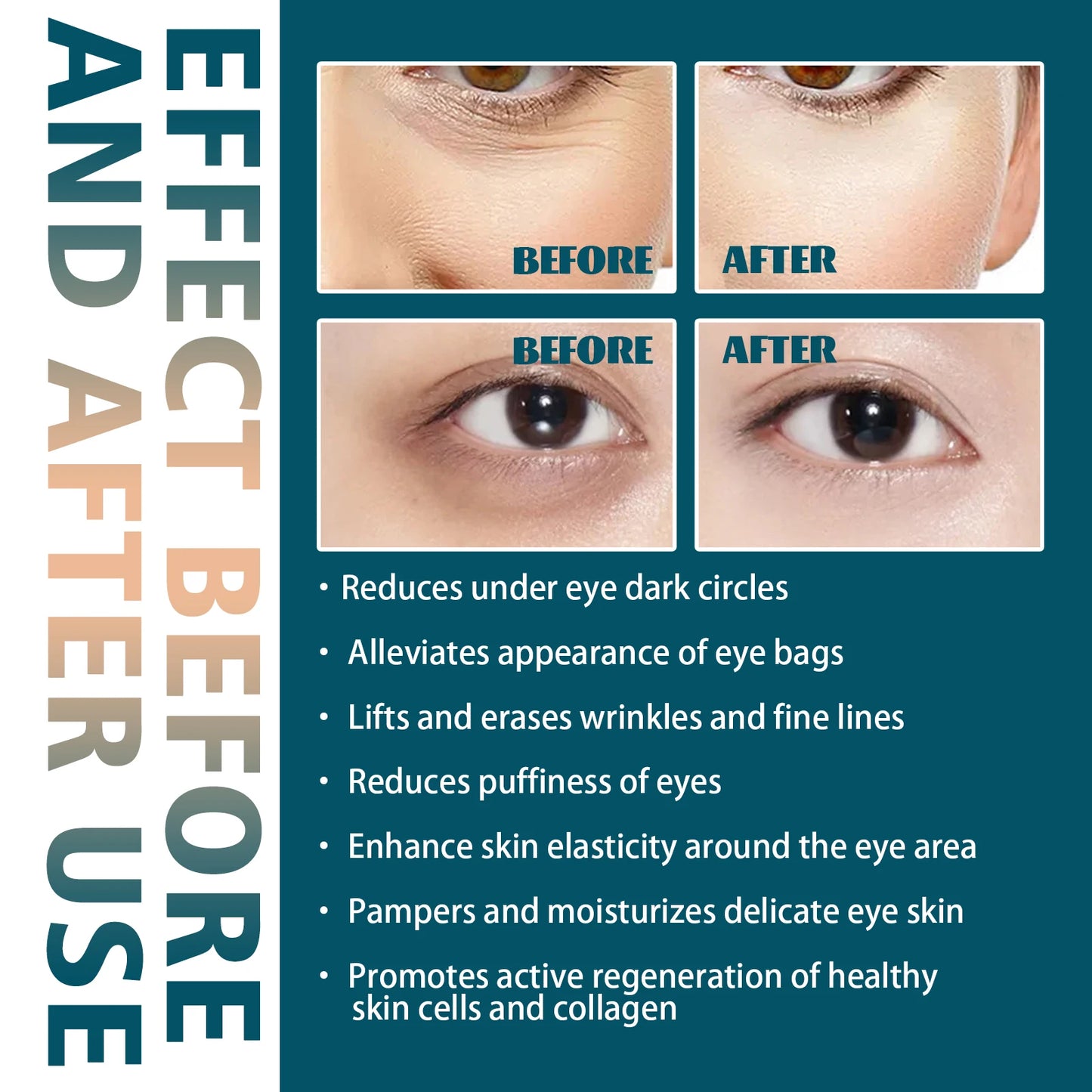 EELHOE Retinol Collagen Eye Cream 30ml Firming Improve Eye Bags Puffiness Remove Dark Circles Nourishing Lifting Eyes Skin Care