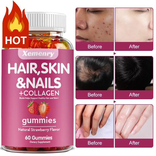 Hair, Skin & Nails + Collagen Gummies - Promotes Healthy Skin, Joints, Hair, Nails, Antioxidants - 60 Gummies